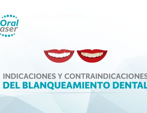 Blanqueamiento dental: indicaciones y contraindicaciones
